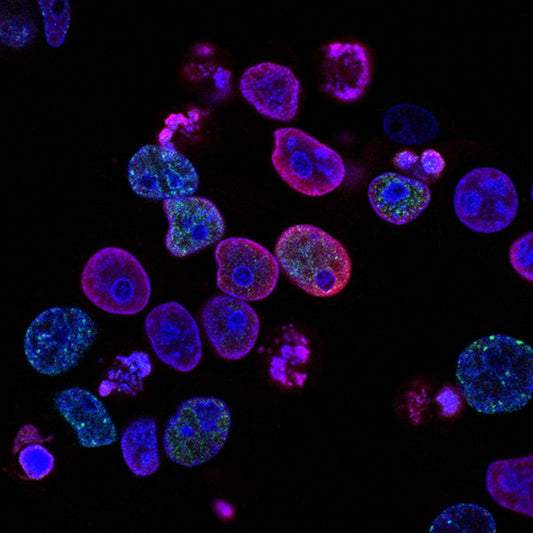 Congélation d'ovocyte et loi bioéthique, où en sommes-nous ?