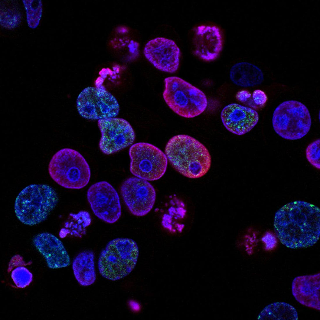 Congélation d'ovocyte et loi bioéthique, où en sommes-nous ?